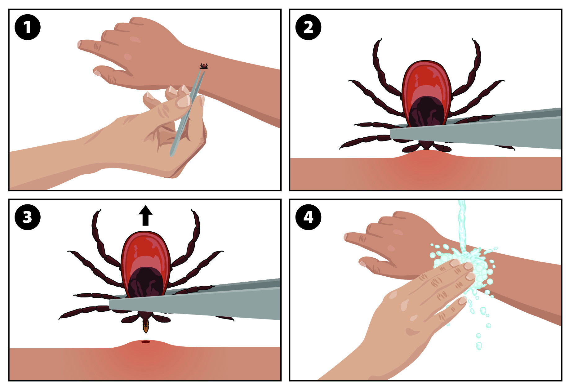 Four-step graphic showing how to remove a tick